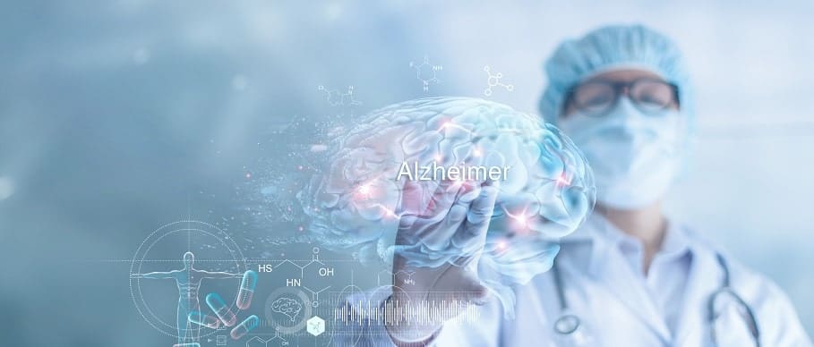 alzheimer