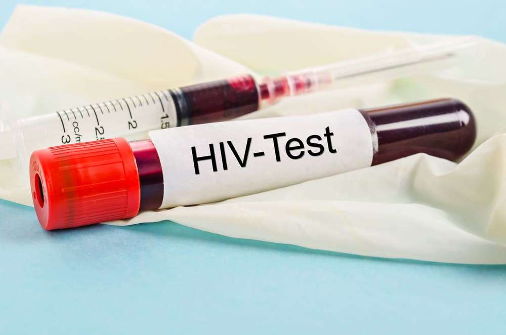 Tubo de ensaio HIV positivo