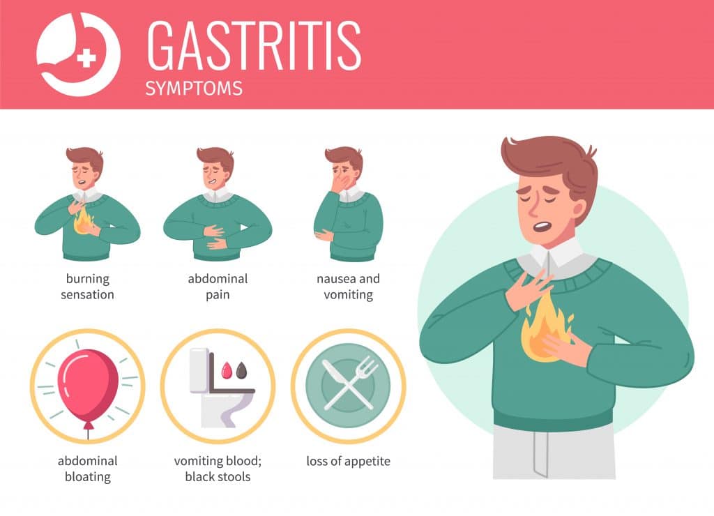 ilustração mostrando sintomas de gastrite