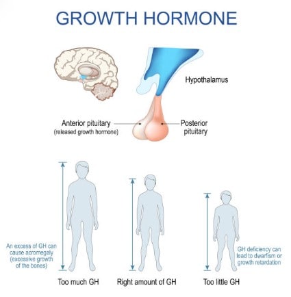 arte explicando como funciona o excesso de hormônio de crescimento