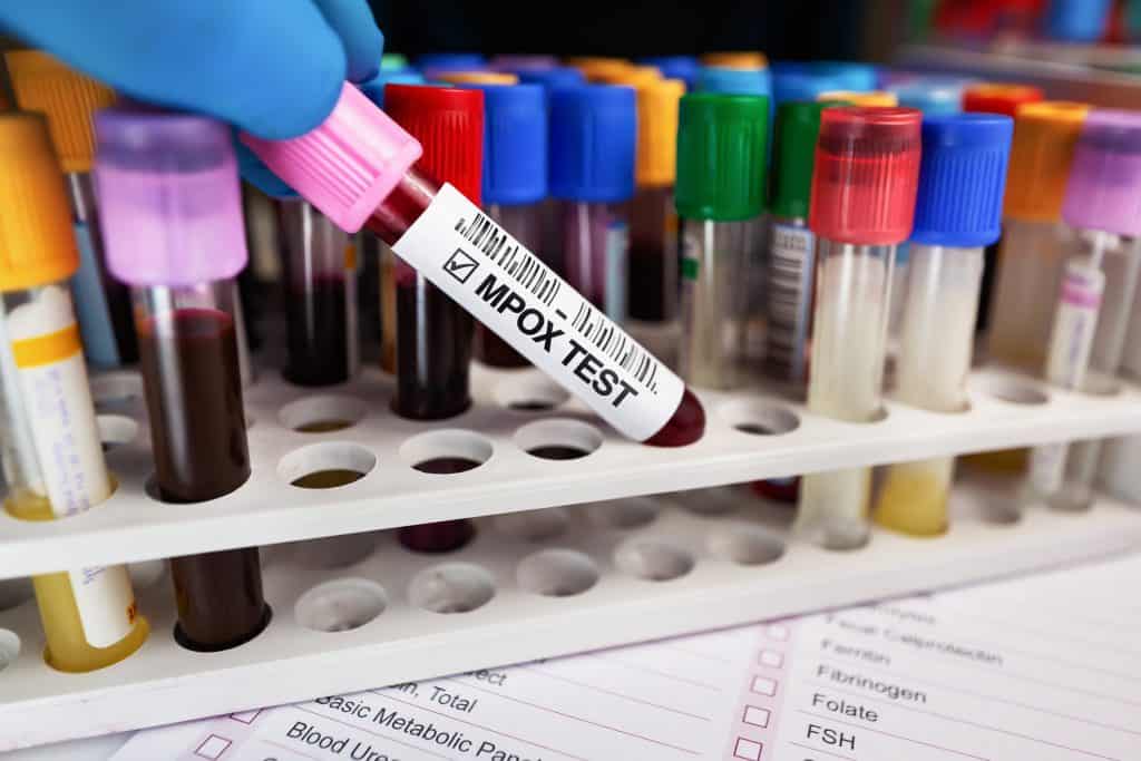 Amostra de sangue em um compartimento específico