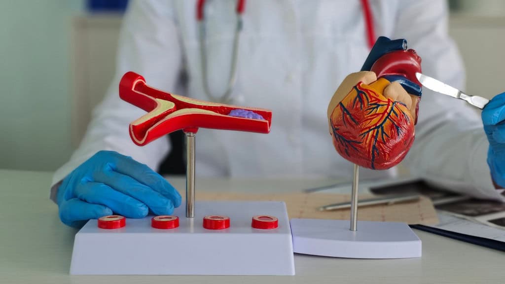 Profissional de saúde demonstra modelos da anatomia do coração, vasos sanguíneos e bisturi. Cirurgia de enxerto de revascularização de artéria coronária com stent