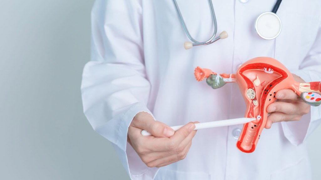 Médico segurando modelo de útero e ovários. Câncer de ovário e de colo do útero, distúrbio do colo uterino, endometriose, histerectomia, miomas uterinos, sistema reprodutivo e conceito de gravidez.