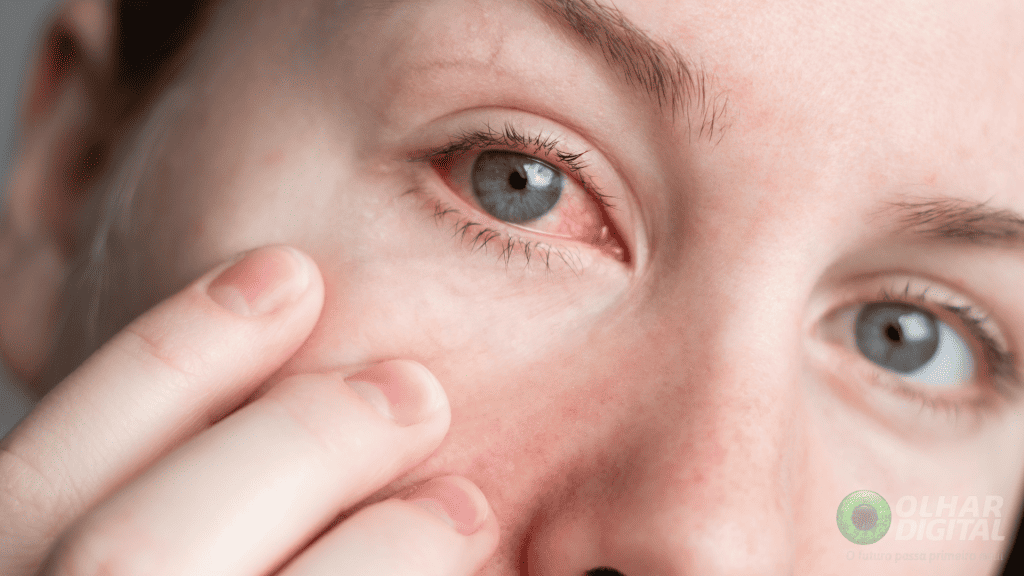 Olhos Vermelhos