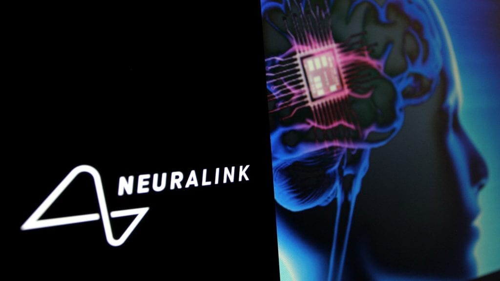 neuralink implante