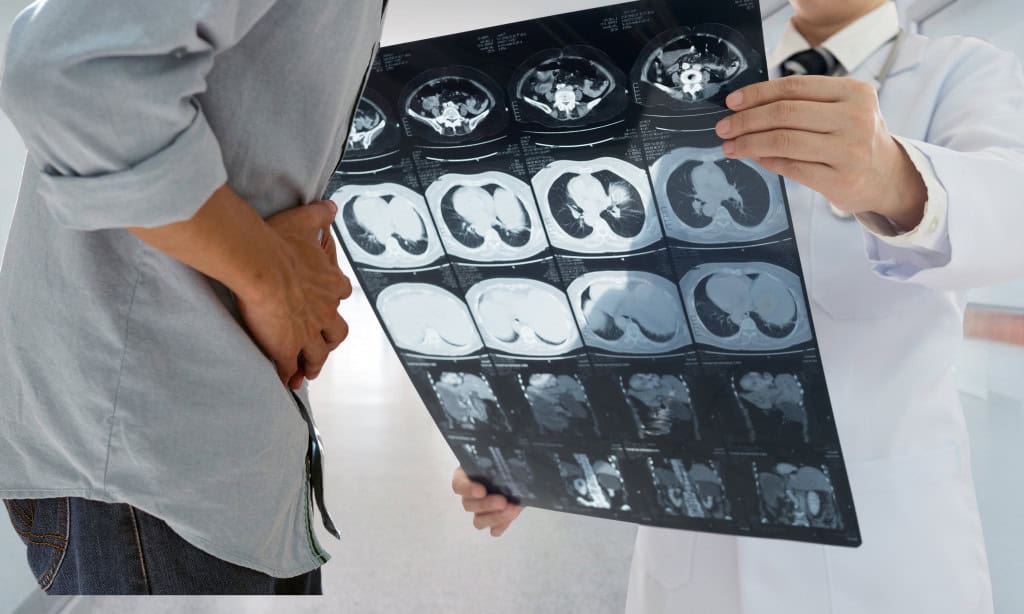 imagem mostra uma tomografia para detectar câncer de estômago