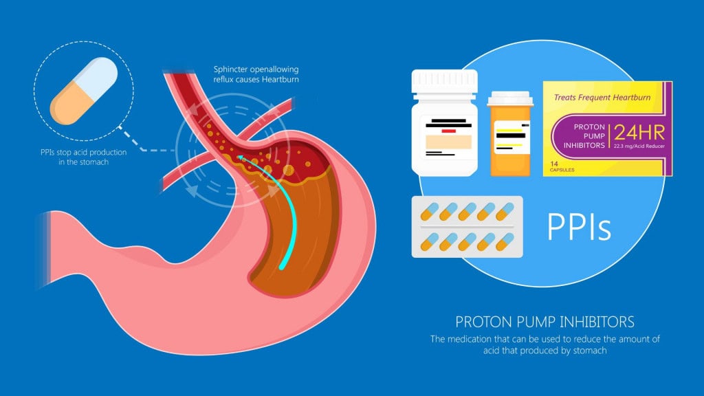 Imagem mostra o interior do corpo humano com foco no estômago e esôfago. Um tubo vermelho representa o esôfago levando alimentos ao estômago, onde há líquido amarelado (ácido). Uma válvula defeituosa permite que esse ácido suba, causando queimação. Ao lado, aparecem remédios em cápsulas e caixas que tratam esse problema, chamados inibidores da bomba de prótons.