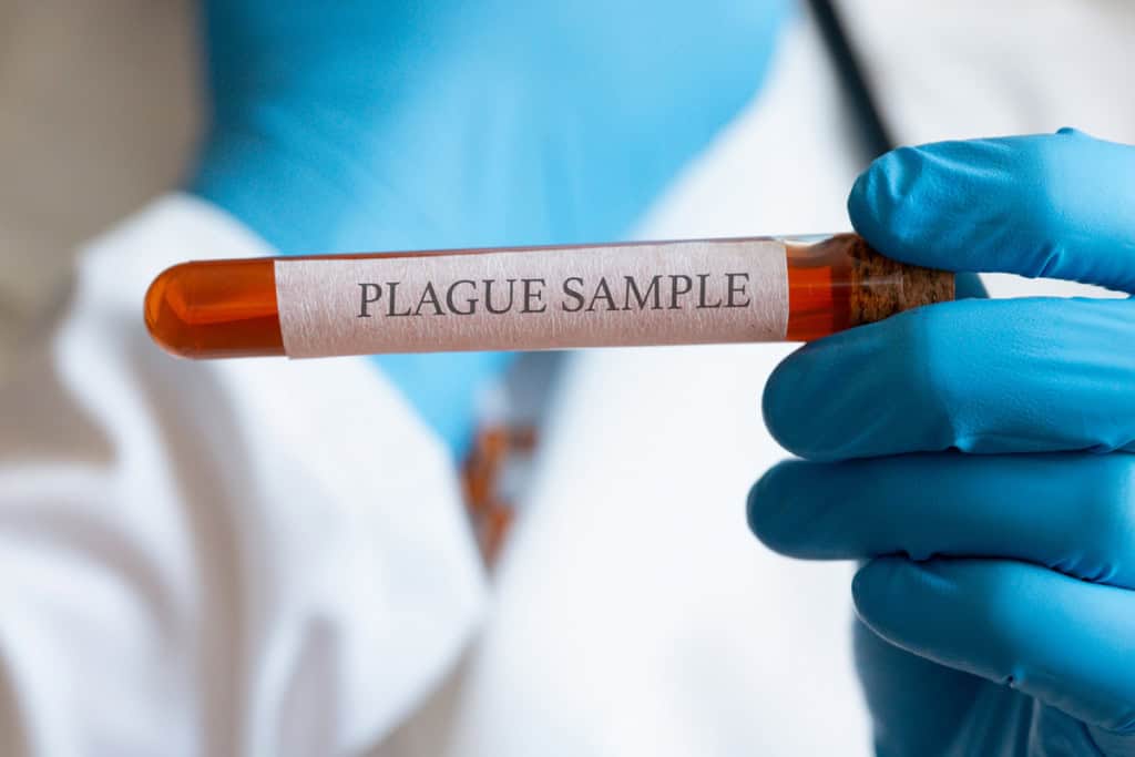 Tubo de ensaio com amostra de peste pneumônica, mãos de médico com luvas azuis, uniforme médico e jaleco branco, fundo de laboratório, close-up; conceito de saúde, medicina e ciência.
